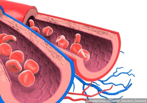 Novo stent intracoronário
