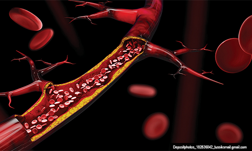 Vinho tinto protege coração e modula microbiota